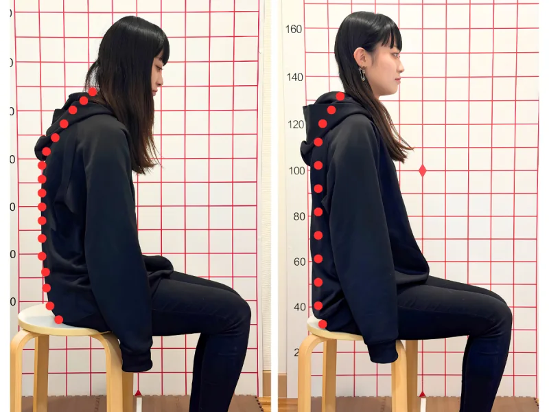 施術前後の姿勢比較：座って丸まっていた背中が伸び、頭が背骨の上にそろった女性（横向き）