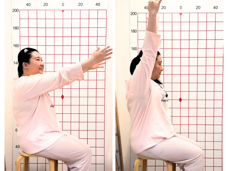 施術前後の比較：腕が上まで上がるようになった女性（座位）