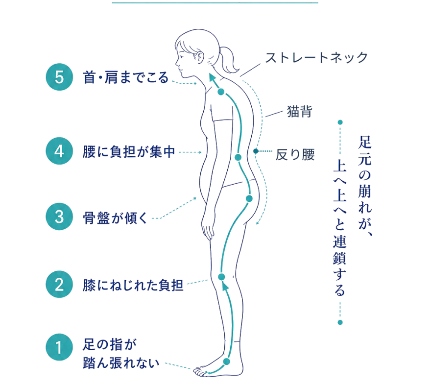 足元の崩れが上へ連鎖する図：足の指が踏ん張れない→膝にねじれた負担→骨盤が傾く→腰に負担が集中→首・肩までこる。姿勢の崩れ＝ストレートネック・猫背・反り腰。